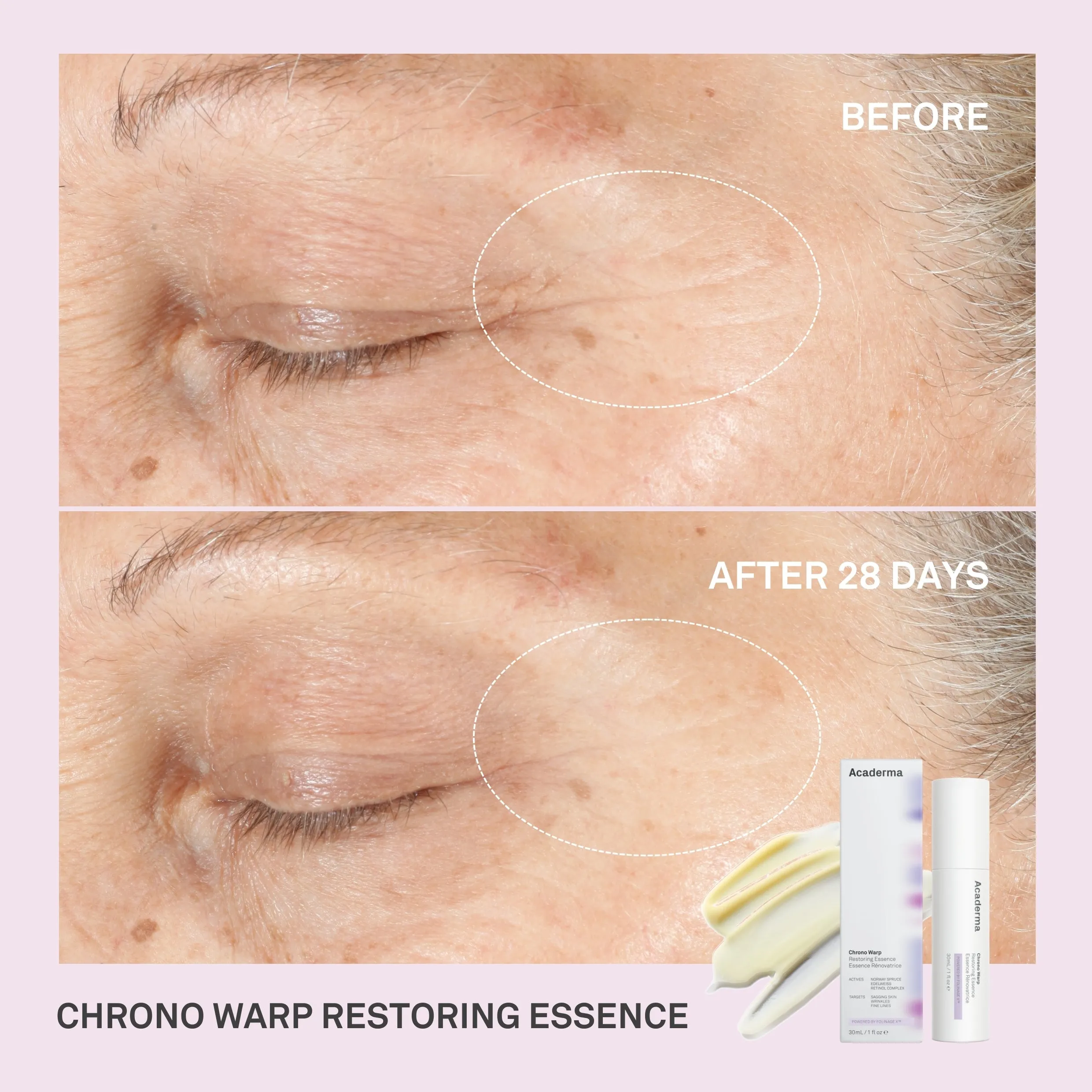 Acaderma Chrono Warp Restoring Essence